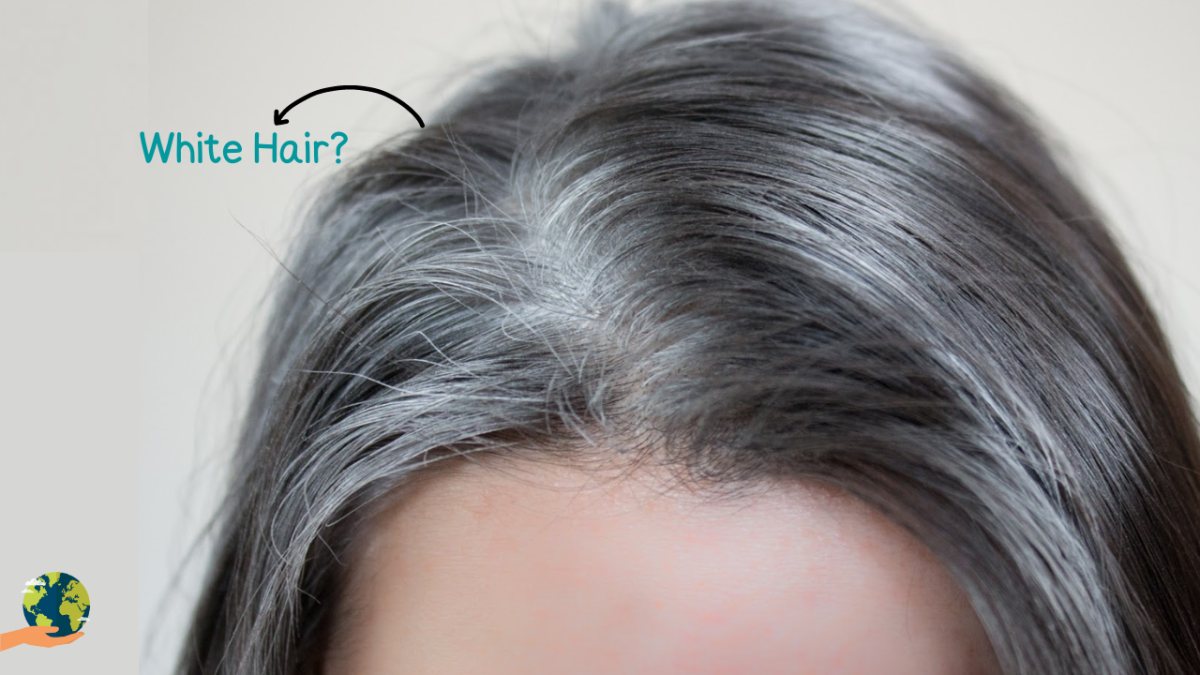 Top Grey Hair Treatment to Prevent White Hair From Spreading